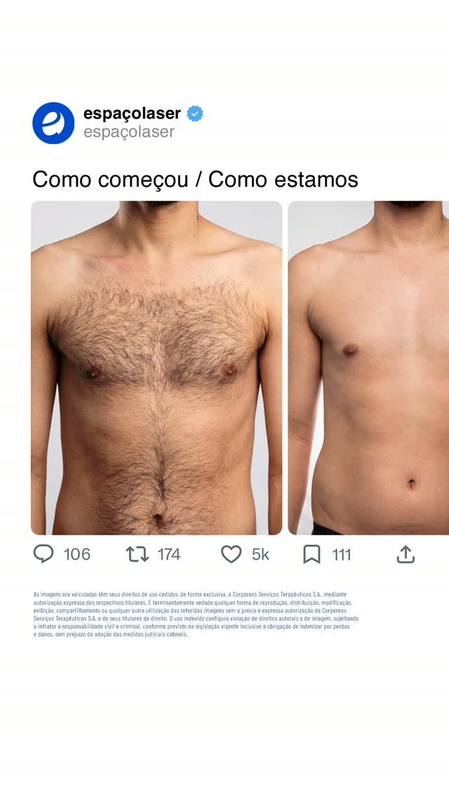 Post de Espaço Laser