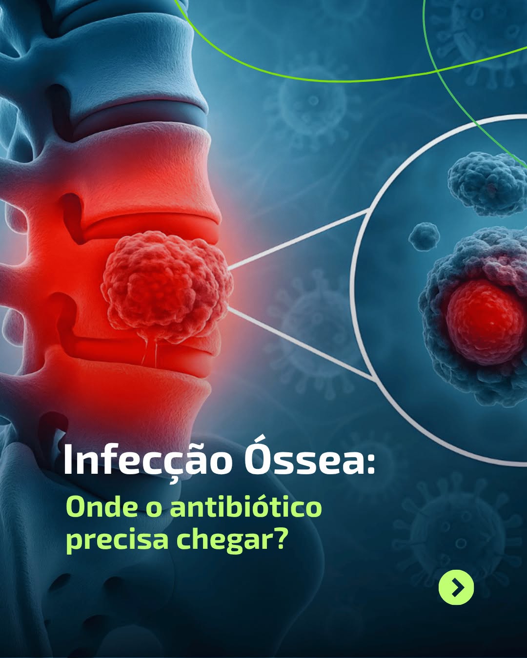 Post de LAS Brasil