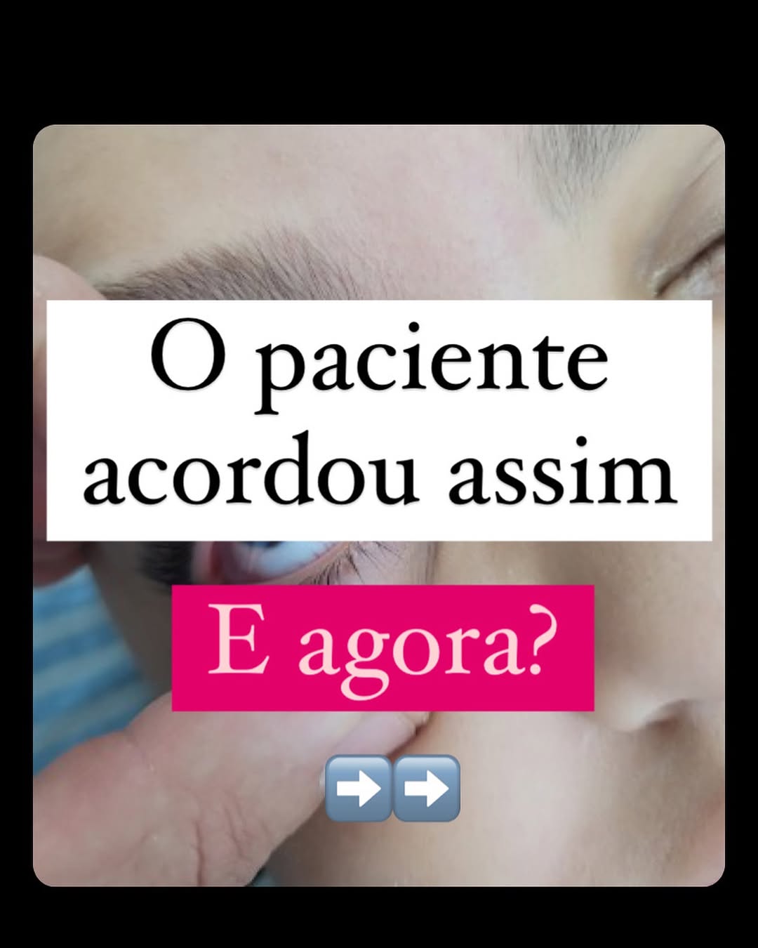Post de Propofando